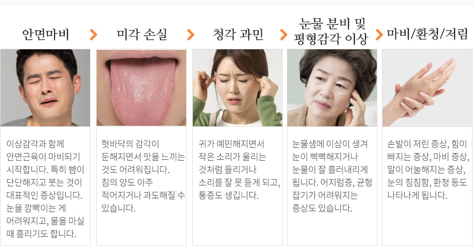 안면마비 진행단계