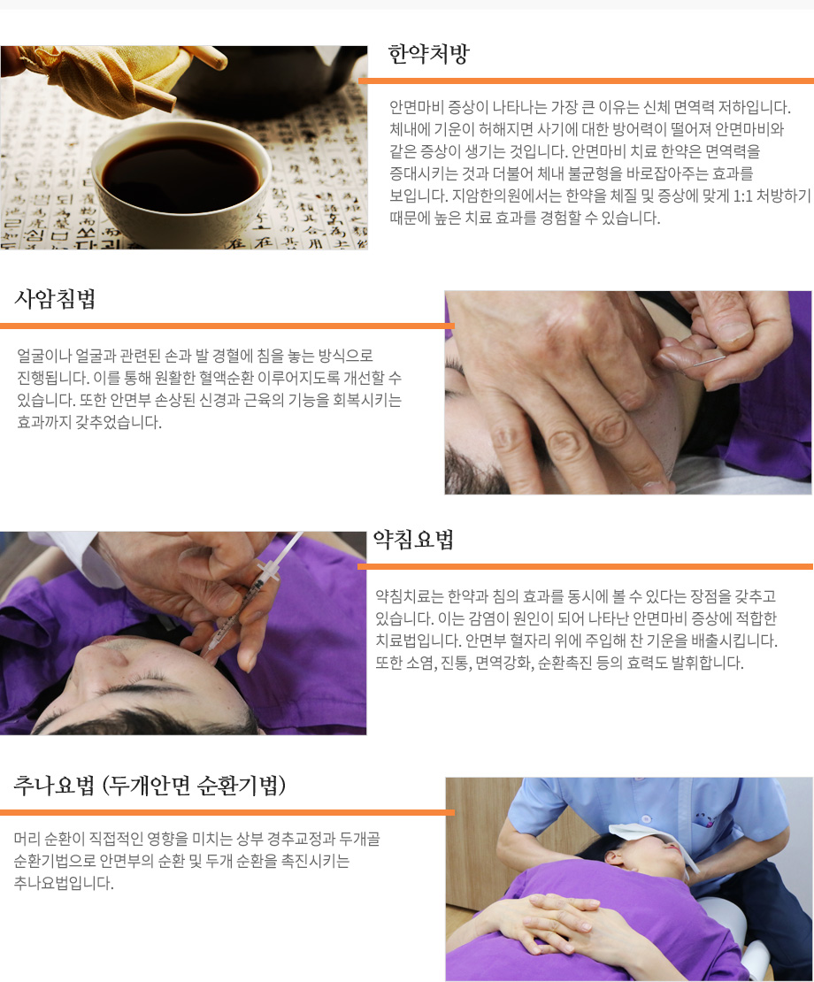 안면마비 효과적인 한방치료