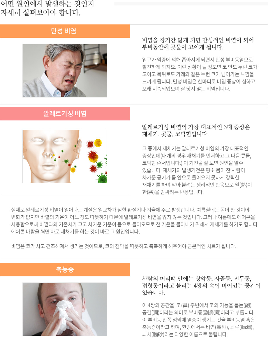 치료가 가능한 비염의 종류