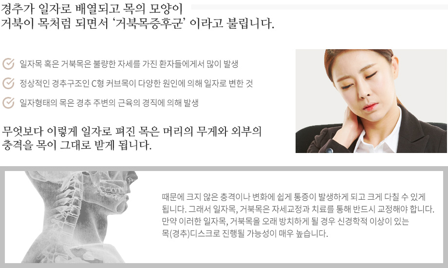 일자목 혹은 거북목