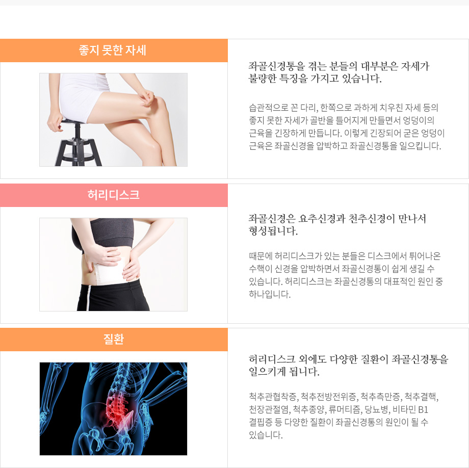 좌골신경통 발생원인