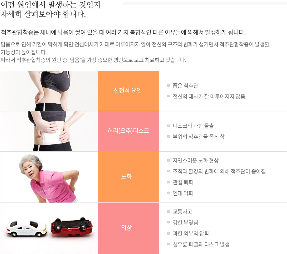 척추관협착증 원인